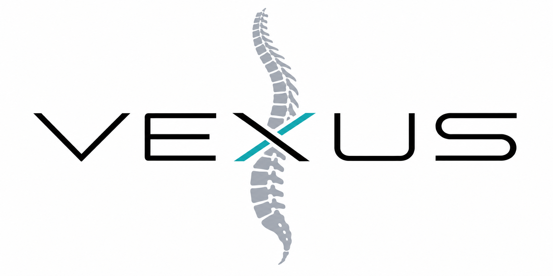 VEXUS