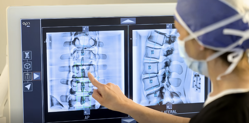 Clinician interacting with a touchscreen planning interface